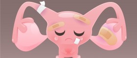 Why People Lose Weight After A Hysterectomy?