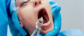 Wisdom Tooth Removal
