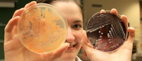 10 Little-Known Facts About Bacteria