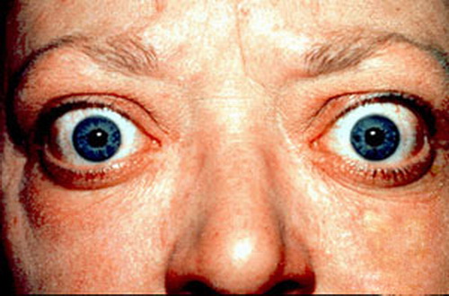 Slideshow picture