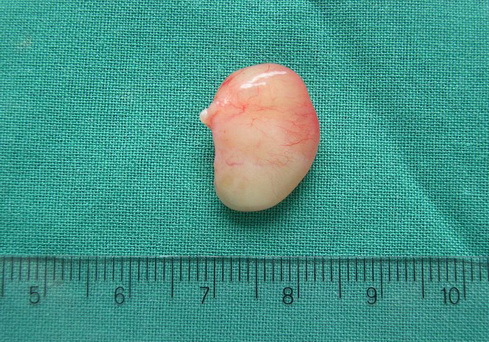 Slideshow picture