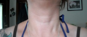 9 Not So Hidden Symptoms You Might Suffer From A Thyroid Disorder