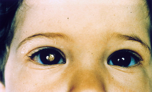 Slideshow picture