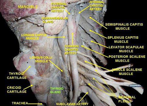 Slideshow picture