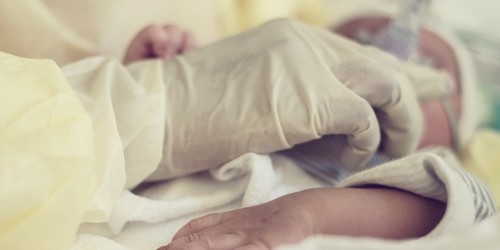 What Is Gastroschisis?