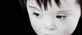 Down's syndrome: What Parents Need to Know