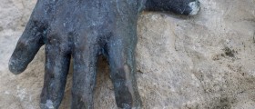 Stone Man Syndrome: What Is Fibrodysplasia Ossificans Progressiva (FOP)?