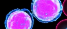 Aplastic Anemia and MDS: Causes, Symptoms, Treatment