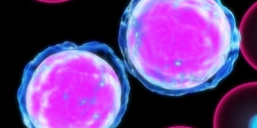 Aplastic Anemia and MDS: Causes, Symptoms, Treatment