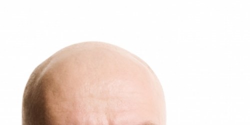 Hair Loss Or An Enlarged Prostate Drugs May Cause Irreversible Sexual Dysfunction And Depression