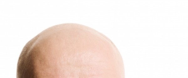 Dutasteride Side Effects Hair Loss