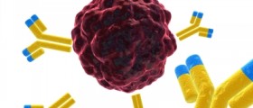 Colon (Colorectal) Cancer:  Risks and Prevention Tips