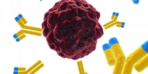 Colon (Colorectal) Cancer:  Risks and Prevention Tips