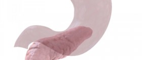 Pancreatic (Pancreas) Cancer Symptoms and Treatment Alternatives