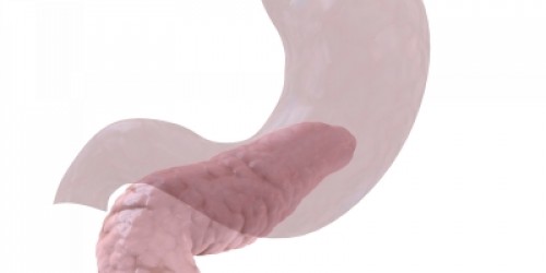 Pancreatic (Pancreas) Cancer Symptoms and Treatment Alternatives