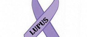 Lupus in Women: Chronic Inflammatory Disease