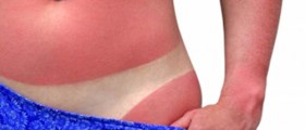 Skin Cancer Melanoma: Symptoms and Treatment Options