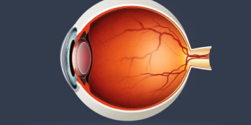 What is Age Related Macular Degeneration?