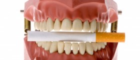 Oral Cancer: Risks, Causes, Symptoms and Treatments