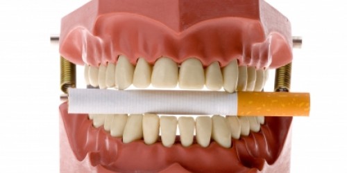 Oral Cancer: Risks, Causes, Symptoms and Treatments