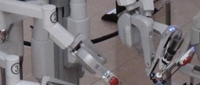Da Vinci Robotic Surgery: Pros and Cons