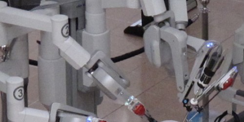 Da Vinci Robotic Surgery: Pros and Cons