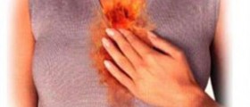 Stress and Heartburn