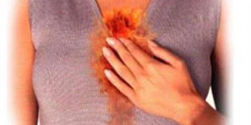 Stress and Heartburn