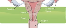 Endometrial/Uterine Cancer