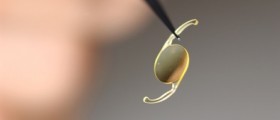 Cataract surgery
