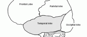 Temporal lobe epilepsy: Diagnosis & Treatment
