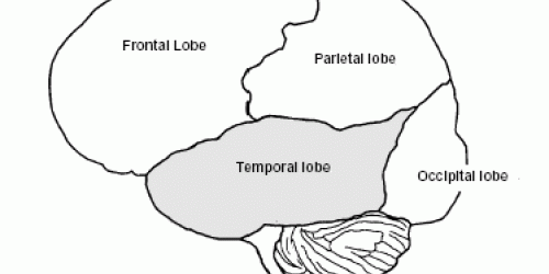 Brain tumor in right temporal lobe recovery time? | Nervous System ...