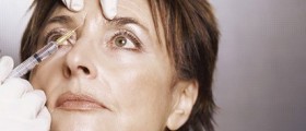 Why Botox?