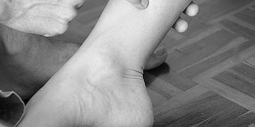 Laser Acupuncture May Help Bedwetters Break Nighttime Habit