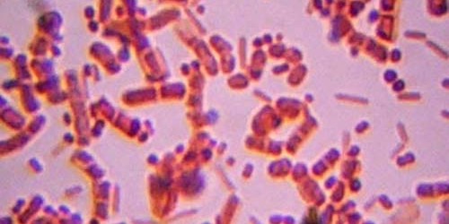 Superbug Clostridium Difficile About to Overtake MRSA in Hospitals