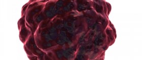Brain Cancer - Treatment Alternatives
