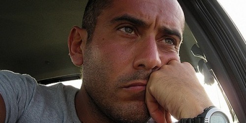 Varicocele: Lifestyle Changes That Optimize Sperm Quantity And Quality