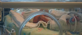 Cancer Drug Avastin Could Prevent Blindness in Premature Babies