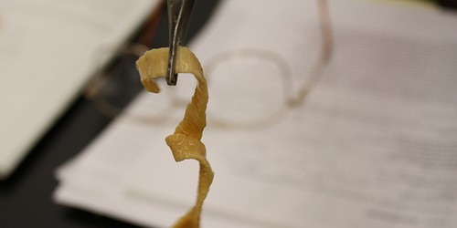 Intestinal Infections with Tapeworm Parasites