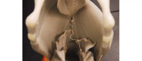 Infection of the Epiglottis