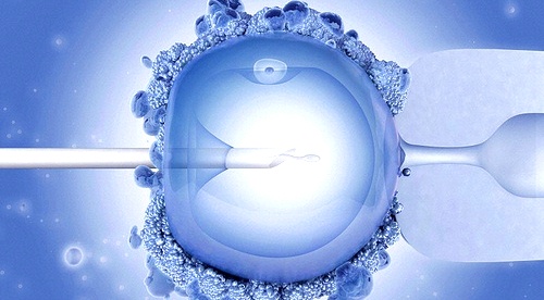 ivf2.jpg