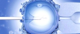High Doses Of Hormones And Ivf Complications