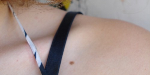 Warning Signs Of Skin Cancer