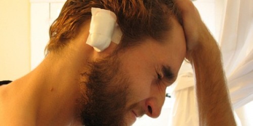 Cosmetic Ear Surgery (Otoplasty): Procedure, Risks, Recovery, and Cost