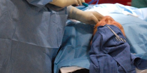 Facelift (Rhytidectomy): Procedure, Risks, and Recovery