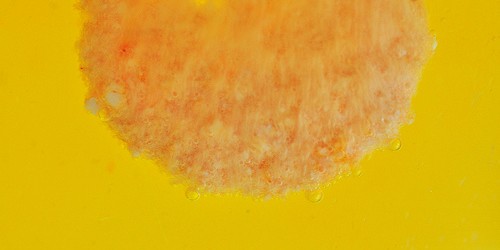 Magnesium Deficiency: A Silent Epidemic?