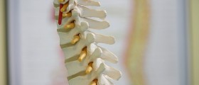 Abdominal Workouts For Prolapsed Disc Patients