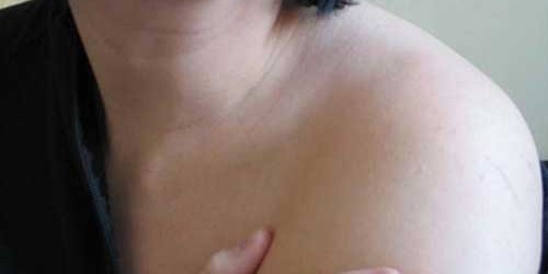 Cure Shoulder Pain- 6 Top Secrets to End Shoulder Problems Revealed