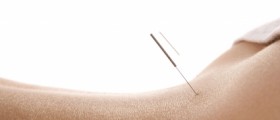 Does Acupressure Work as Well as Acupuncture?