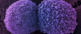 Will We Test for Cervical Cancer at Home?